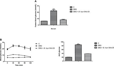 Oral Administration of Bacillus toyonensis Strain SAU-20 Improves Insulin Resistance and Ameliorates Hepatic Steatosis in Type 2 Diabetic Mice